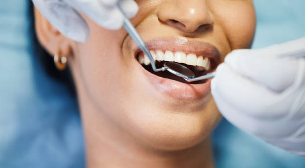 Best Emergency Treatment for Toothache in Shallowater, TX