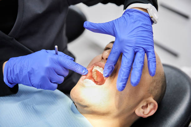 Best Emergency Tooth Extraction in Shallowater, TX